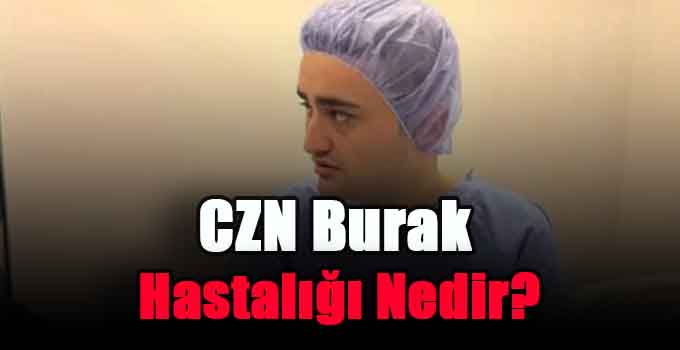 CZN Burak Hastalığı Nedir?
