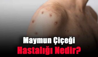 Maymun Çiçeği Hastalığı Nedir?