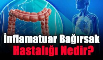İnflamatuar Bağırsak Hastalığı Nedir?