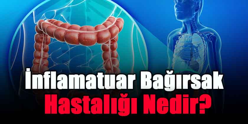 İnflamatuar Bağırsak Hastalığı Nedir?