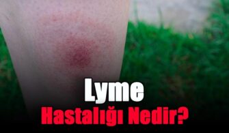Lyme Hastalığı Nedir?