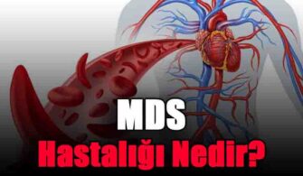 mds-hastaligi-nedir