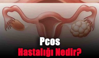 Pcos Hastalığı Nedir?