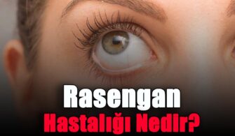 Rasengan Hastalığı Nedir?