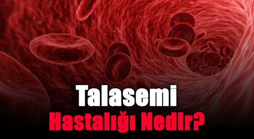 Talasemi Hastalığı Nedir?